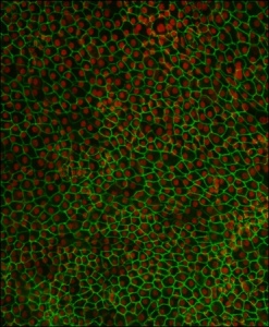 Retinal cells grown from stem cells.