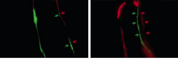 Fluorescent imaging mouse spines. Treatment with NELL-1 (right) shows greater bone formation compared to untreated mice (left). Credit: Broad Stem Cell Research Center