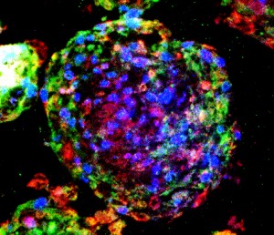 Red and green indicate lung stem cells within a spheroid. (Image credit: Henry et al. Stem Cells Trans Med September 2015-0062)