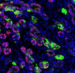 Functioning human pancreatic cells after they’ve been transplanted into a mouse. (Image: Saiyong Zhu, Gladstone)