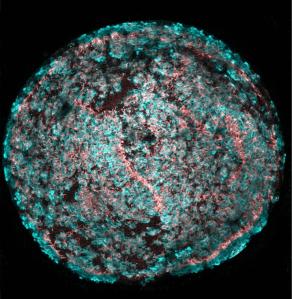 A new technique converts stems cells into hair cells. Image credit Will McLean, Albert Edge, Massachusetts Eye and Ear
