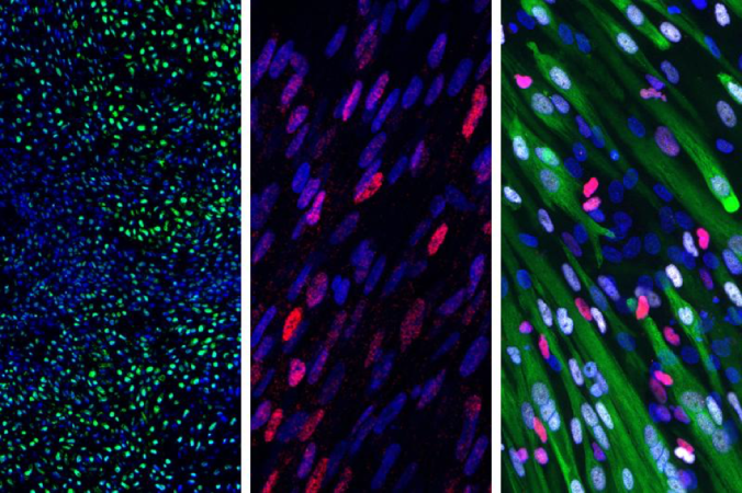 The new protocol turned 90 percent of human pluripotent stem cells into somite cells in just four days; those somite cells then generated (left to right) cartilage, bone and muscle cells.  Image: April Pyle Lab/UCLA 